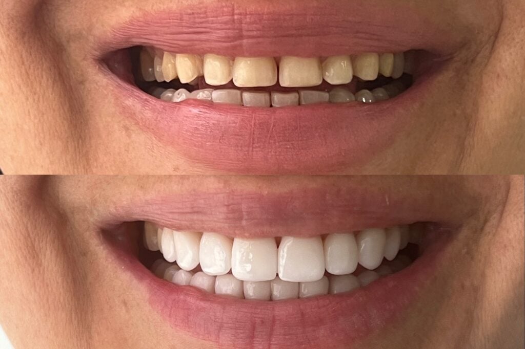 Rehabilitación Oral